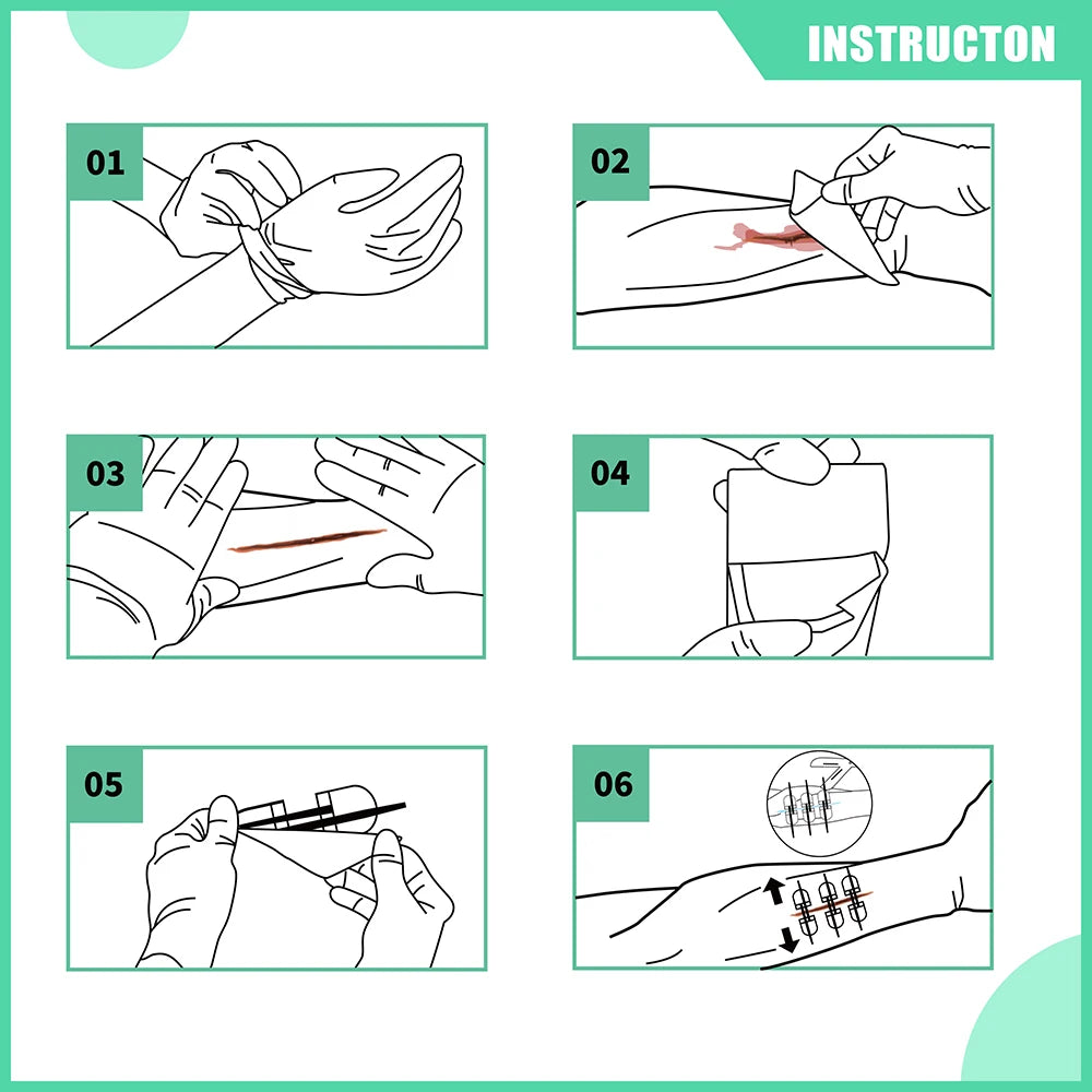 6 Piece Wound Closure Strips Kit with Disinfectant Pads and Dressings