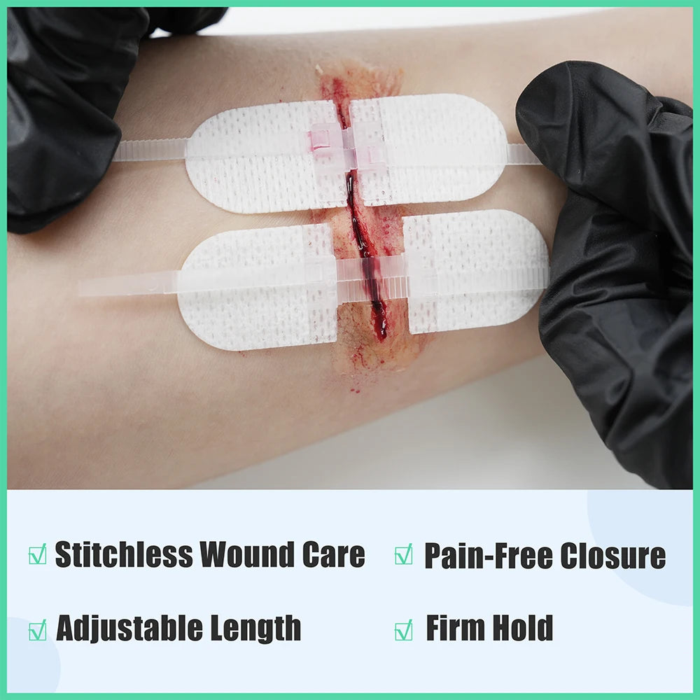 6 Piece Wound Closure Strips Kit with Disinfectant Pads and Dressings